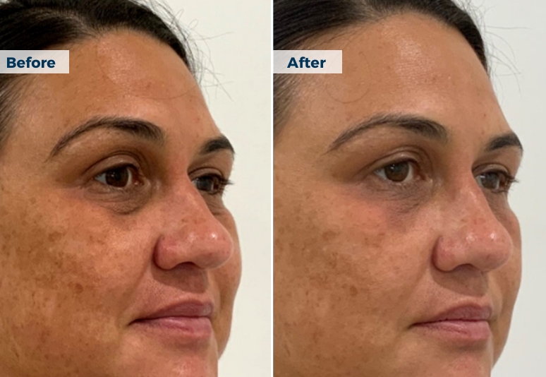 Skin Repair Skin Cancer Centre in Townsville, Queensland